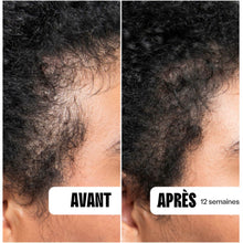 Load image into Gallery viewer, Dermaroller 0,25 mm pour Microneedling des cheveux/de la barbe - POPMYCURLS BOX PARIS