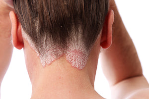 Formation diagnostic capillaire (expertise en trichologie)